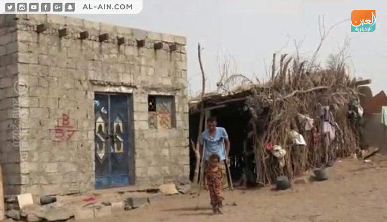 عثمان جلاجل أحد ضحايا ألغام الحوثي في قرية المسنا قرية المسنا بمحافظة الحديدة تعاني من جرائم الحوثي ضد الإنسانية