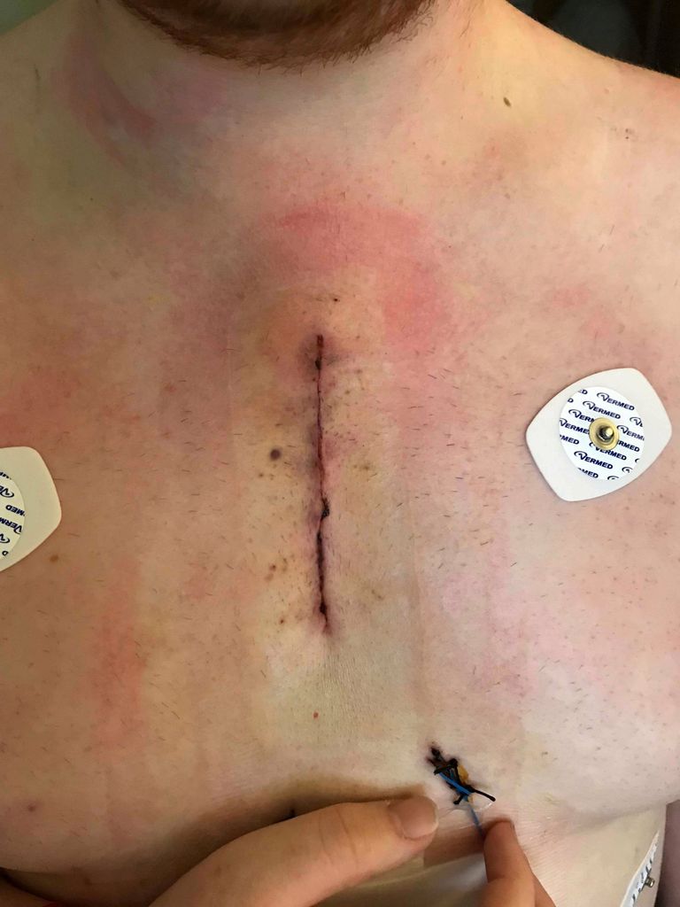 جورج كوكس يحمل ساعة أبل