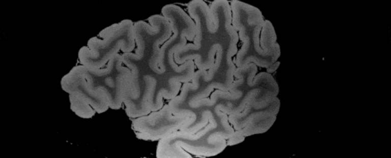 الدماغ البشري