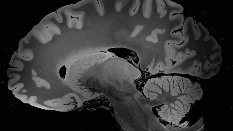 الدماغ البشري