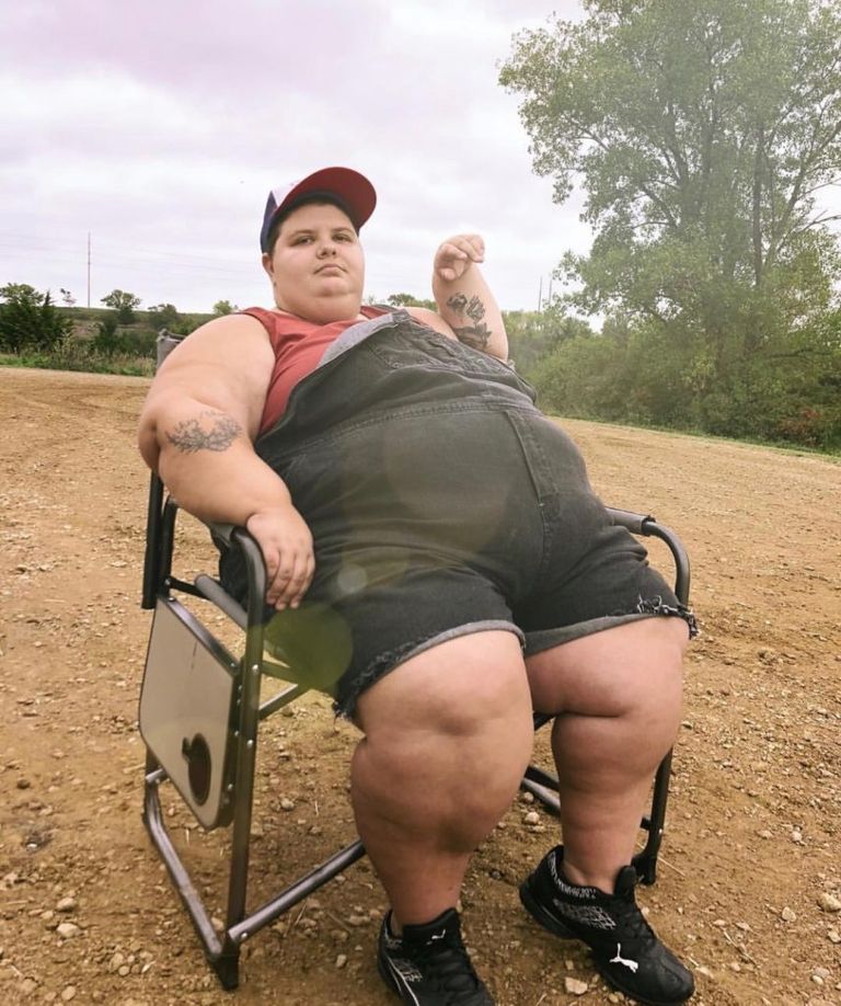 البدانة تؤثر على التنمية المستدامة مثل الجوع