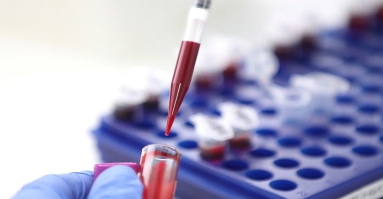 طفرة في المنتجات التكنولوجية عالميا