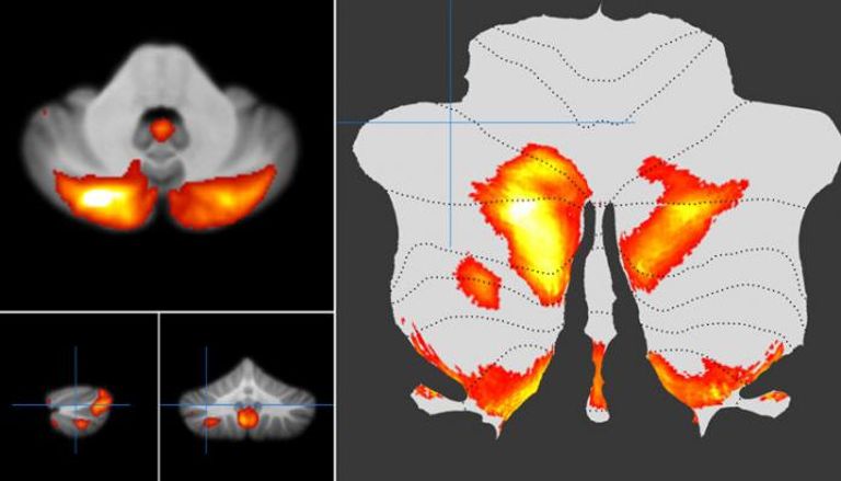 الباحثون يأملون في أن تساعد خريطة المخيخ في دراسة بعض اضطرابات الدماغ
