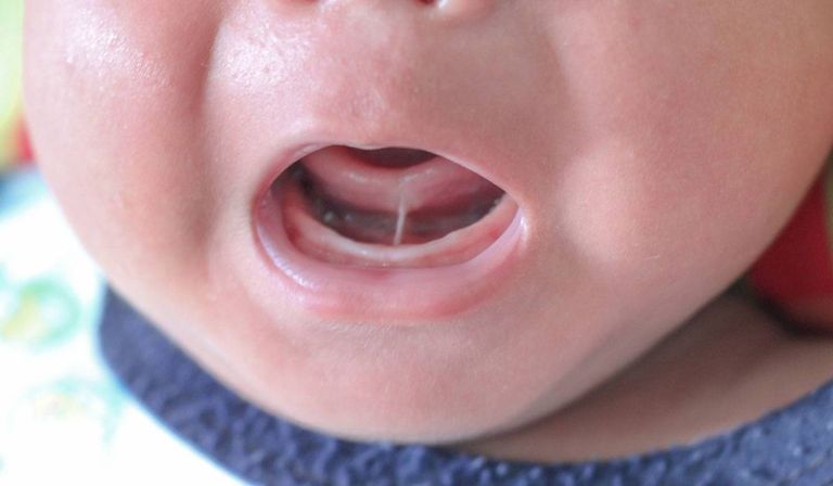 التدخين يؤدي إلى تشوهات خلقية لدى الجنين
