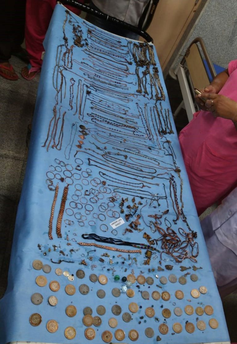 استخراج مجوهرات بـ66 ألف دولار من بطن امرأة