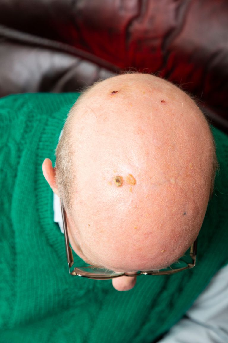 100 دولار غرمة إطعام طيور النورس في بريطانيا