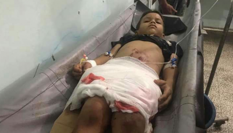 قذائف مليشيا الحوثي تقتل أطفال اليمن