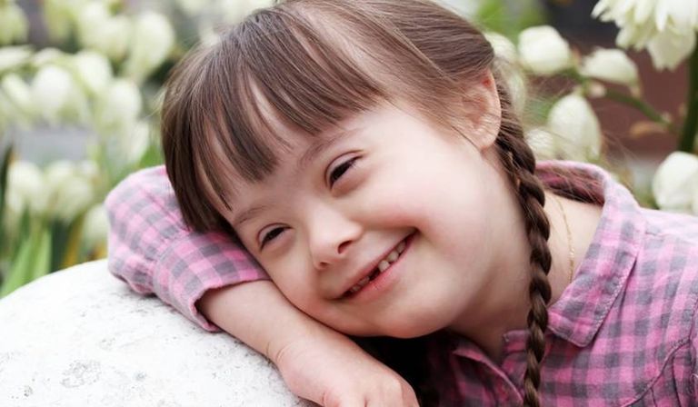 حالة "أطفال داون" تتطلب عناية خاصة