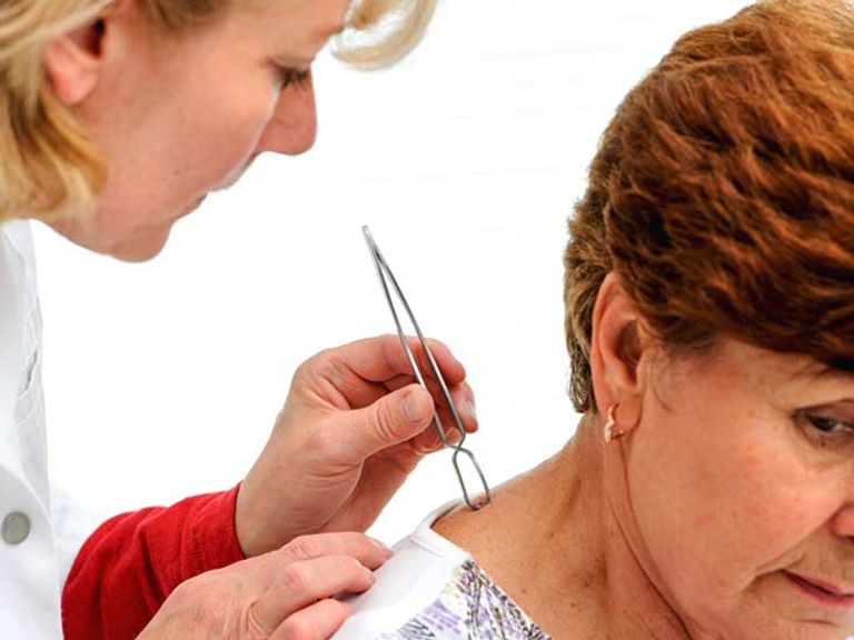 "داء القراد" يزداد انتشاراً في أوروبا وأمريكا الشمالية