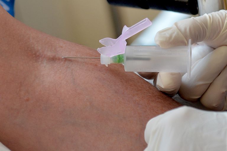 اختبار يبعث الأمل في العلاج من ألزهايمر