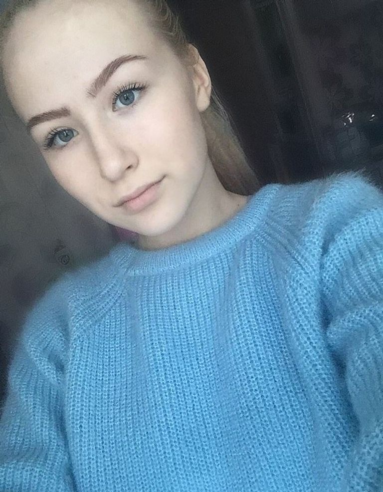 سونيا تشرنيغوفا.. ضحية الدب البني في روسيا