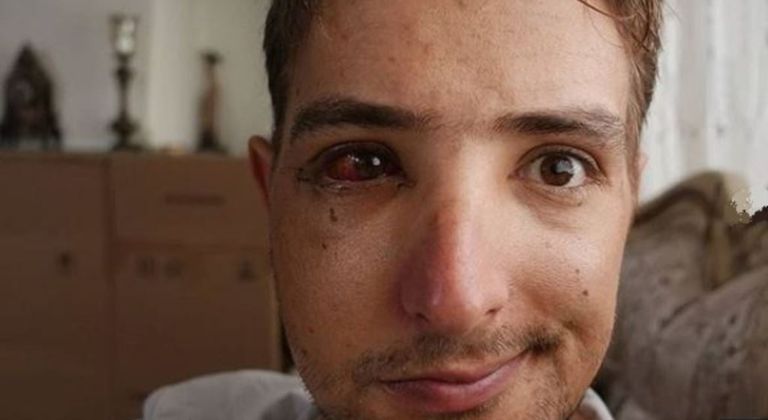 فيليب راكب الدراجات بعد تعنيفه