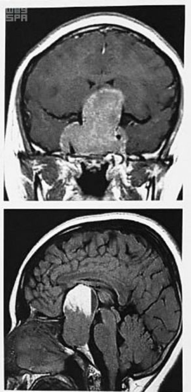 الفريق الطبي الذي أجرى العملية