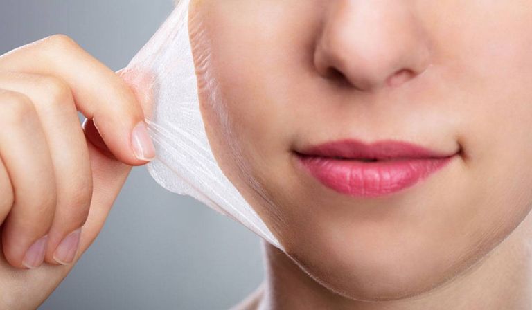 التقشير الكيمائي.. الحل السحري لمشكلات البشرة