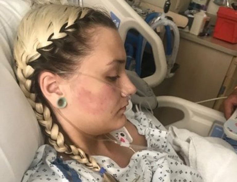 بدأت معاناة مادي بعد شعورها بألم شديد في الظهر والكلى