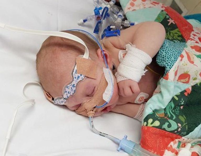 الطفلة هولي