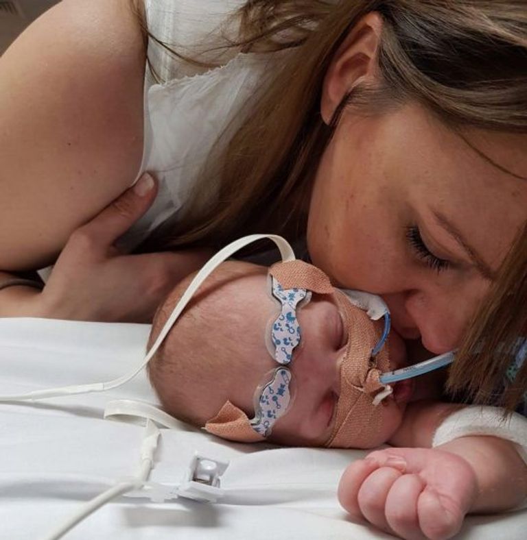 الطفلة هولي