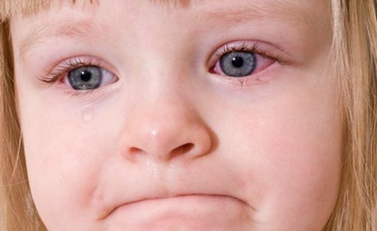 العدوى تنتشر بين الأطفال في المدارس - أرشيفية