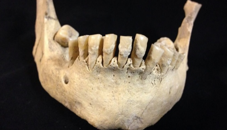 عينة من الأسنان التي تم تحليلها 