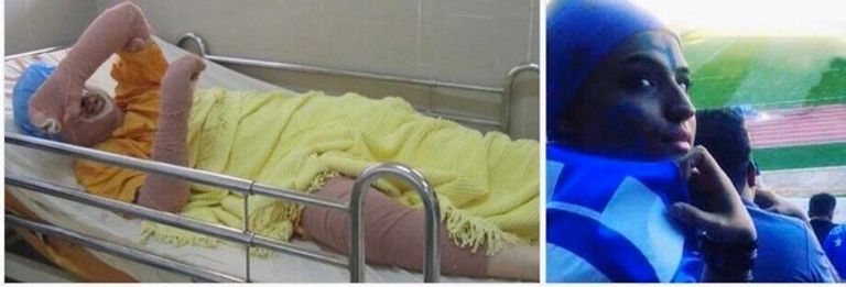 المشجعة الإيرانية تخضع للعلاج في مستشفي محلي - أرشيفية مشجعات نادي استقلال الإيراني- أرشيفية