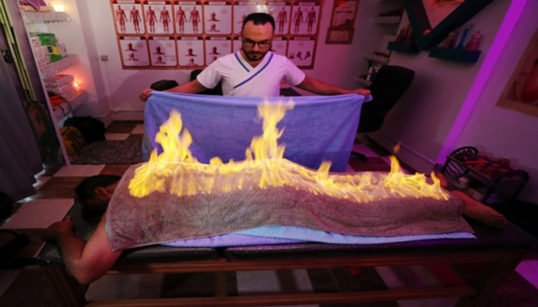مُدلك مصري يستخدم النار لتخفيف آلام العضلات