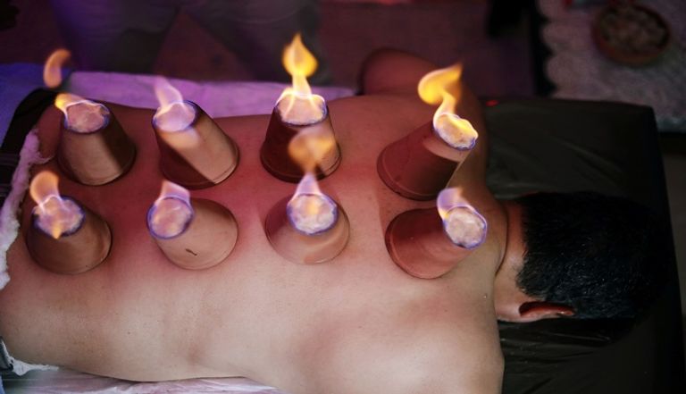 مُدلك مصري يستخدم النار لتخفيف آلام العضلات