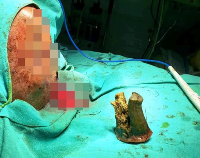 المسن الهندي شيام لال ياداف