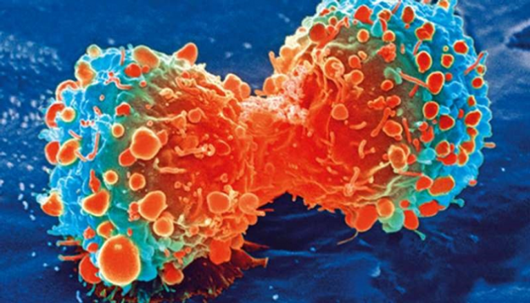 الخلايا السرطانية خلال انقسامها - أرشيفية