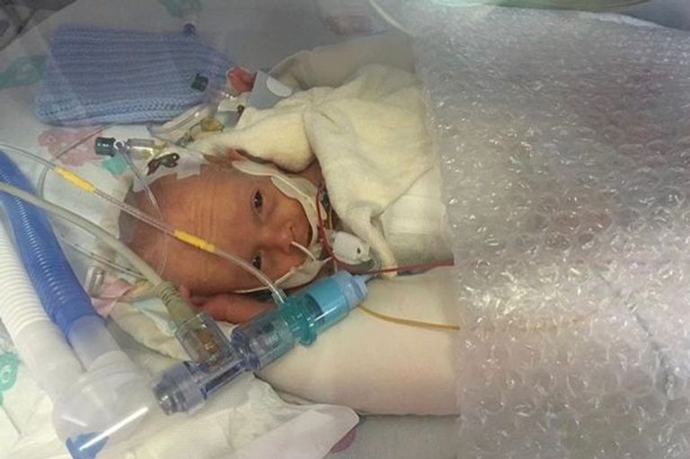 الرضيع الشفاف