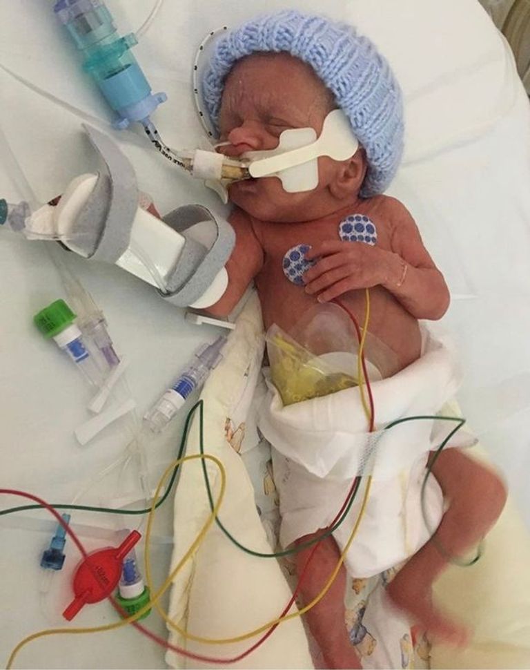 الرضيع الشفاف