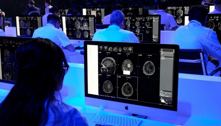 الذكاء الاصطناعي يساعد في كسب الوقت عند تشخيص ورم في الدماغ