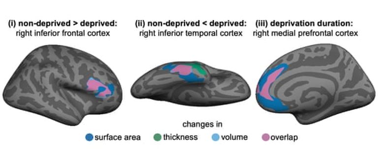 الحرمان في الصغر يمتد تأثيره إلى الكبر - أرشيفية