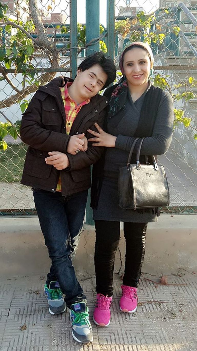 مصطفى نوفل.. أول موديل مصري من متلازمة داون