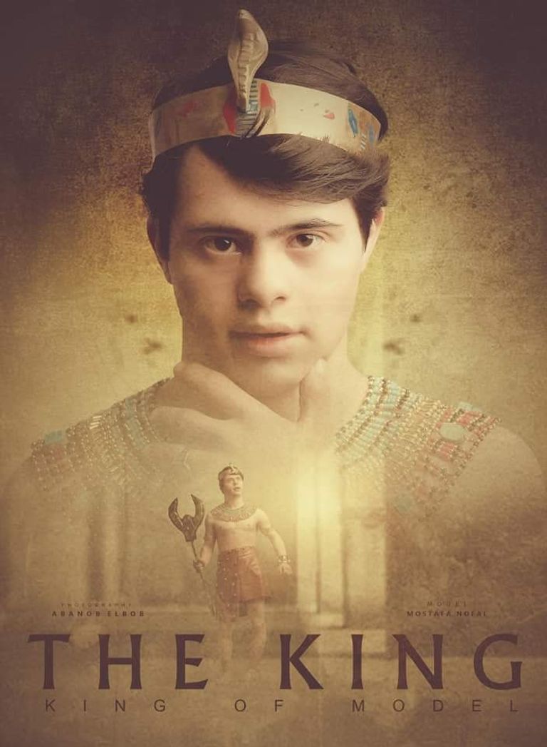 مصطفى نوفل.. أول موديل مصري من متلازمة داون