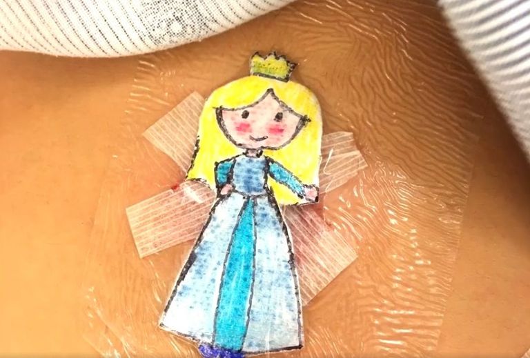 الدكتور باري أثناء عمله ضمادات الأطفال الكارتونية