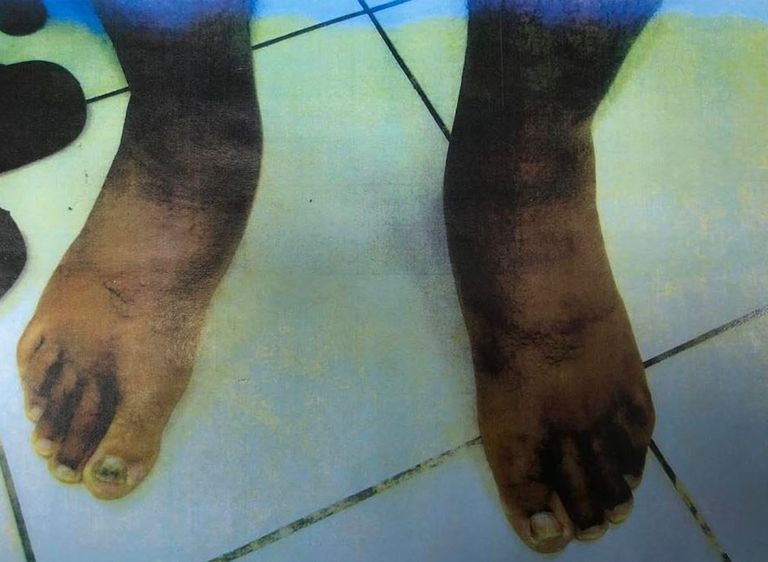 الأسير الفلسطيني وليد حناتشة