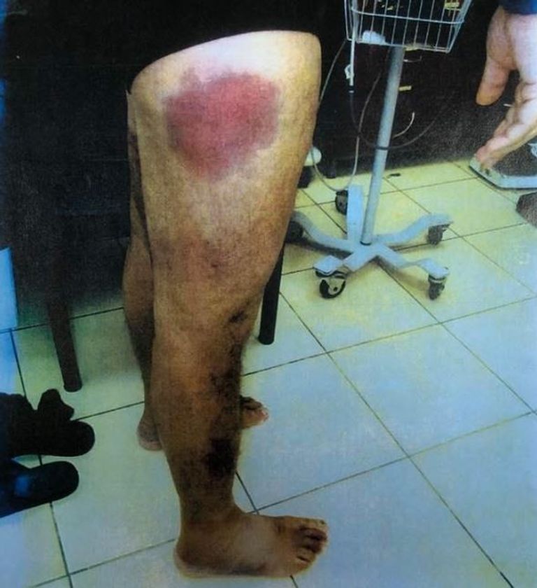 الأسير الفلسطيني وليد حناتشة