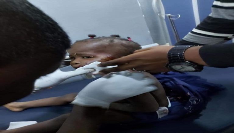 مصاب في انفجار العاصمة السودانية الخرطوم