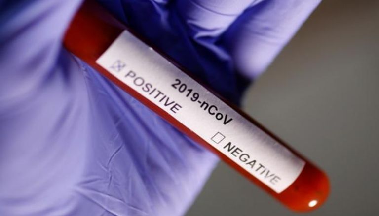 الاختبار الجديد قد يحدد سلالة 2019 من الفيروس - أرشيفية