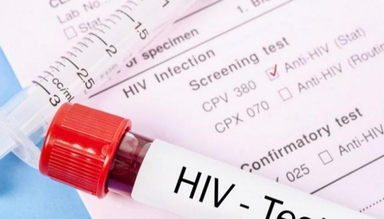 العلماء نجحوا في صياغة الخطوات الأولية لعدوى فيروس "الإيدز"