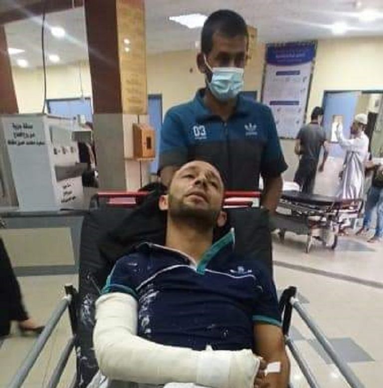 الشاب الفلسطيني عمار رأفت أبو العلا بعد الاعتداء عليه عناصر من سرايا القدس بحركة الجهاد الفلسطينية