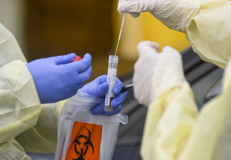 فحص الأجسام المضادة في فيروس كورونا عالم يصيب نفسه مرتين بكورونا لدراسة الأجسام المضادة