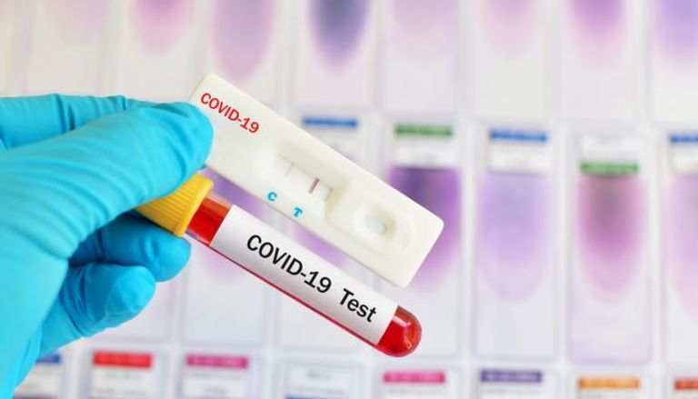 اختبار الفحص السريع لفيروس كورونا (كوفيد-19)