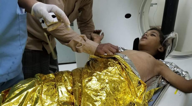 هلع الأطفال جراء القصف الحوثي