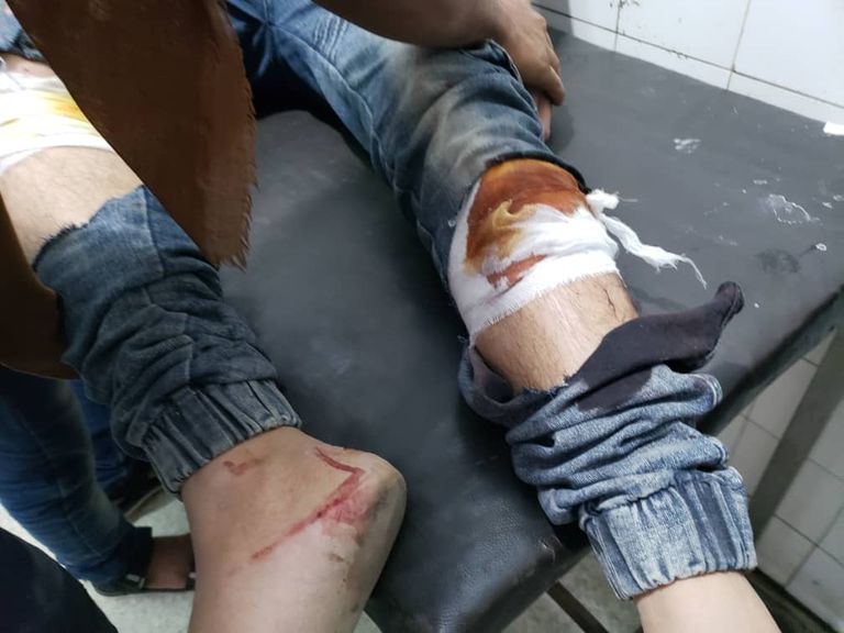 ضحايا القصف الحوثي على تعز آثار القصف الحوثي على تعز