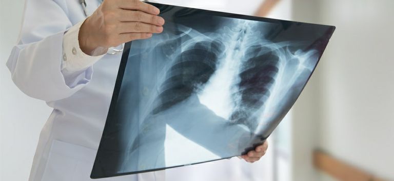 الأشعة السينية اكتشفت عام 1895