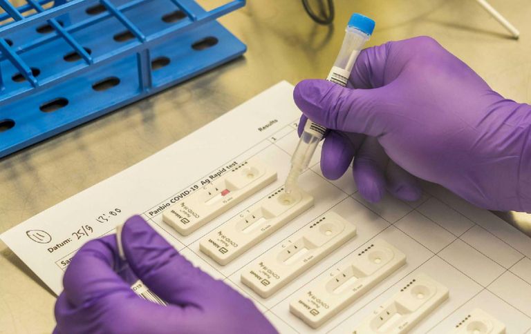 كورونا حول العالم