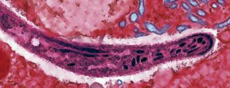 الملاريا تنتقل إلى البشر من خلال لدغات البعوض