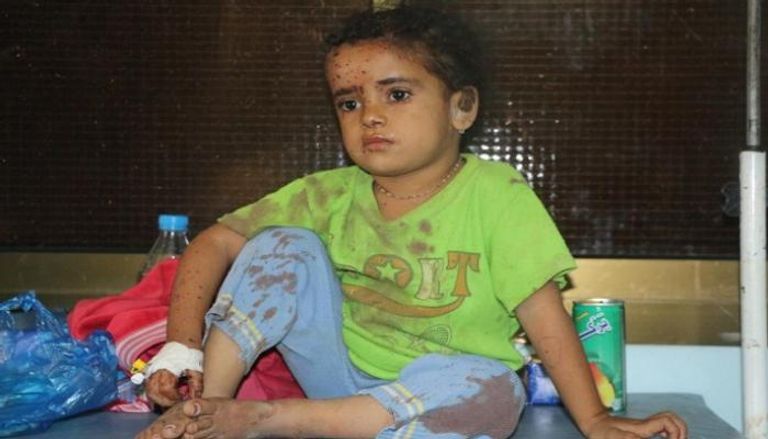 طفل يمني من ضحايا الإرهاب الحوثي