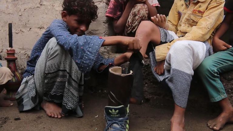 أطفال اليمن عرضة للموت نتيجة مخلفات الإرهاب الحوثي